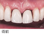 �p�O