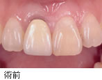 �p�O