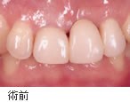 �p�O